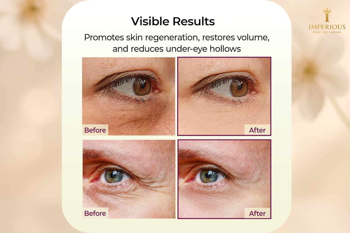 Black Friday Mega Deal – Get 50% Off Today ONLY R419.99 – Limited Stock. Botox in a Stick - Dr.Melaxin Cemenrete Calcium Multi Balm