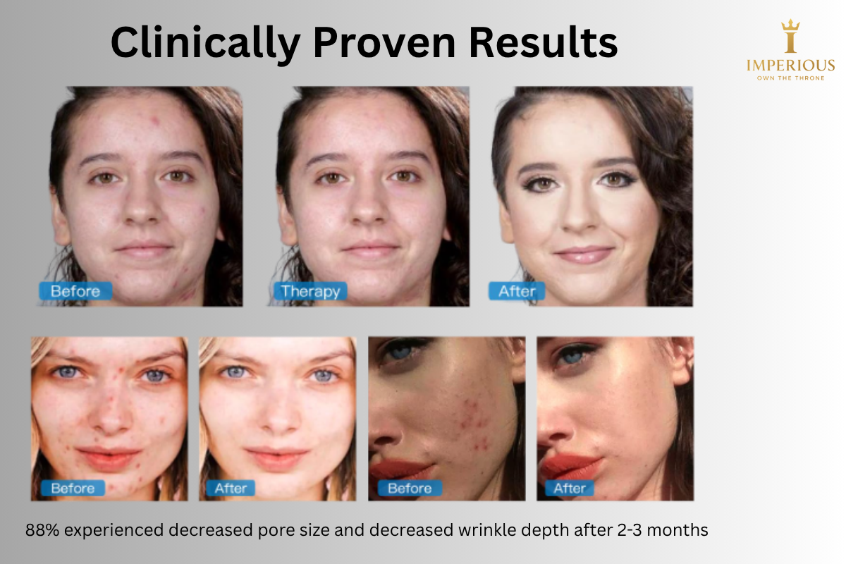 LED Light Therapy Face Mask - 7 Colors Led Facial Mask Acne Wrinkle Removal Photodynamic Led Facial Mask Wireless Use